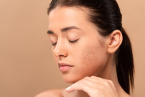 How to Minimize Pores